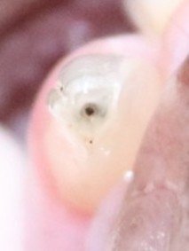Cat Tooth Fracture Guide